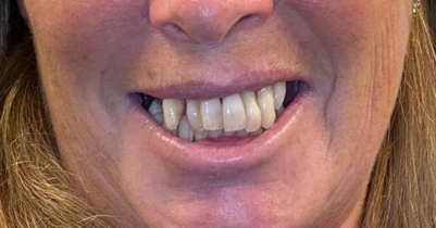 Case 1 — before