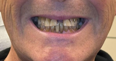 Case 2 — before