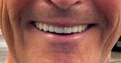 Case 2 — after