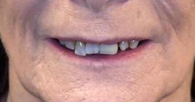 Case 4 — before